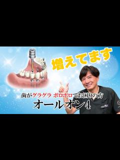 [x]ここ数年増えてきたオールオン4について - YouTube